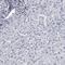 Fatty Acid Binding Protein 4 antibody, HPA002188, Atlas Antibodies, Immunohistochemistry frozen image 