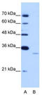Exosome Component 6 antibody, TA343970, Origene, Western Blot image 