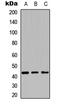 Cytochrome P450 Family 27 Subfamily C Member 1 antibody, LS-C354333, Lifespan Biosciences, Western Blot image 