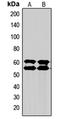 SMAD2 antibody, LS-C352472, Lifespan Biosciences, Western Blot image 