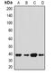 SH3 Domain Containing GRB2 Like 2, Endophilin A1 antibody, orb382035, Biorbyt, Western Blot image 