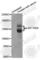 c-Kit antibody, AP0286, ABclonal Technology, Western Blot image 