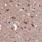HYLS1 Centriolar And Ciliogenesis Associated antibody, HPA041210, Atlas Antibodies, Immunohistochemistry paraffin image 