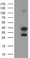 Ubiquitin Conjugating Enzyme E2 J1 antibody, TA504974AM, Origene, Western Blot image 