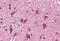 Alkylglycerone Phosphate Synthase antibody, MBS242734, MyBioSource, Immunohistochemistry frozen image 