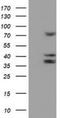Cytochrome P450 Family 2 Subfamily B Member 6 antibody, NBP2-01800, Novus Biologicals, Western Blot image 