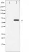 Serine/Threonine Kinase 11 antibody, TA325910, Origene, Western Blot image 