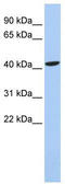 LIM Homeobox 4 antibody, TA330531, Origene, Western Blot image 