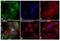 Progesterone Receptor antibody, MA5-12658, Invitrogen Antibodies, Immunofluorescence image 