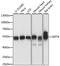 Septin 8 antibody, LS-C749984, Lifespan Biosciences, Western Blot image 