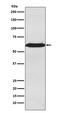 U2 Small Nuclear RNA Auxiliary Factor 2 antibody, M03639-2, Boster Biological Technology, Western Blot image 