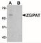 Zinc finger CCCH-type with G patch domain-containing protein antibody, NBP2-41146, Novus Biologicals, Western Blot image 