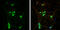 RAB7A, Member RAS Oncogene Family antibody, GTX132548, GeneTex, Immunofluorescence image 