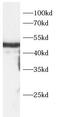 CRDGF antibody, FNab10384, FineTest, Western Blot image 