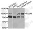 RAS P21 Protein Activator 4 antibody, A9860, ABclonal Technology, Western Blot image 