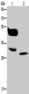 MAGE Family Member A8 antibody, TA350149, Origene, Western Blot image 