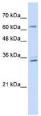 RELB Proto-Oncogene, NF-KB Subunit antibody, TA343617, Origene, Western Blot image 