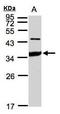 Intercellular Adhesion Molecule 2 antibody, GTX106555, GeneTex, Western Blot image 