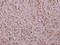 Yes Associated Protein 1 antibody, A00116, Boster Biological Technology, Immunohistochemistry frozen image 