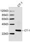 Cardiotrophin-1 antibody, LS-C203225, Lifespan Biosciences, Western Blot image 