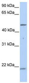 K10 antibody, TA346187, Origene, Western Blot image 