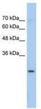 Glutathione S-Transferase Mu 1 antibody, TA346205, Origene, Western Blot image 