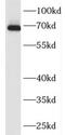 Family With Sequence Similarity 171 Member A2 antibody, FNab10443, FineTest, Western Blot image 