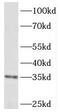Quinone oxidoreductase PIG3 antibody, FNab06437, FineTest, Western Blot image 