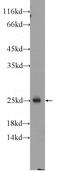 C25KG antibody, 13412-1-AP, Proteintech Group, Western Blot image 