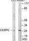 CCAAT Enhancer Binding Protein Delta antibody, EKC1730, Boster Biological Technology, Western Blot image 