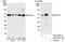 Splicing Factor 3a Subunit 3 antibody, A302-507A, Bethyl Labs, Western Blot image 