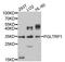 Peptidoglycan recognition protein 1 antibody, abx126355, Abbexa, Western Blot image 