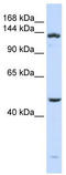 ADAM Metallopeptidase With Thrombospondin Type 1 Motif 18 antibody, TA337618, Origene, Western Blot image 