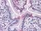 Fatty acid-binding protein, intestinal antibody, GTX83361, GeneTex, Immunohistochemistry paraffin image 