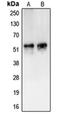 CaM Kinase Like Vesicle Associated antibody, orb215280, Biorbyt, Western Blot image 