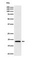 Eukaryotic translation initiation factor 1A, X-chromosomal antibody, M09001, Boster Biological Technology, Western Blot image 