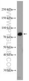 CXXC Finger Protein 1 antibody, 27963-1-AP, Proteintech Group, Western Blot image 