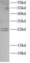 Growth Factor Receptor Bound Protein 2 antibody, FNab10315, FineTest, Western Blot image 