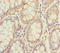 Serine/Threonine Kinase 24 antibody, A54344-100, Epigentek, Immunohistochemistry paraffin image 