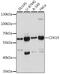 Cyclin Dependent Kinase 19 antibody, 16-434, ProSci, Western Blot image 