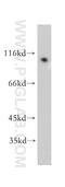 Nuclear factor NF-kappa-B p100 subunit antibody, 51085-1-AP, Proteintech Group, Western Blot image 