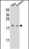 LSM7 Homolog, U6 Small Nuclear RNA And MRNA Degradation Associated antibody, PA5-48257, Invitrogen Antibodies, Western Blot image 