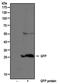 Ubiquitin Specific Peptidase 5 antibody, NB100-56402, Novus Biologicals, Western Blot image 