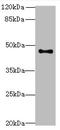 Arylacetamide Deacetylase Like 2 antibody, A62030-100, Epigentek, Western Blot image 