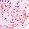 Promyelocytic leukemia protein antibody, orb214410, Biorbyt, Immunohistochemistry paraffin image 