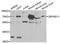 Zinc Finger MYND-Type Containing 11 antibody, A6327, ABclonal Technology, Western Blot image 