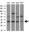 Fibroblast Growth Factor 2 antibody, GTX84502, GeneTex, Western Blot image 