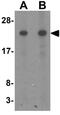 TSC22 Domain Family Member 3 antibody, GTX32107, GeneTex, Western Blot image 