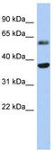 Retinol Dehydrogenase 10 antibody, TA337803, Origene, Western Blot image 