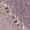 Homeobox protein MOX-1 antibody, HPA045214, Atlas Antibodies, Immunohistochemistry paraffin image 